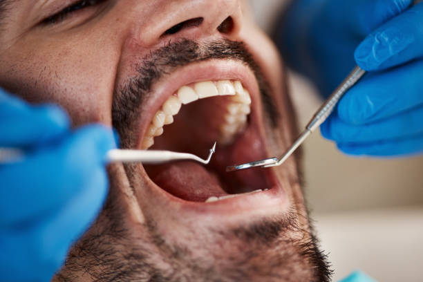 Best Teeth Whitening  in Mantachie, MS