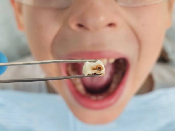 Best Emergency Dentist for Kids  in Mantachie, MS